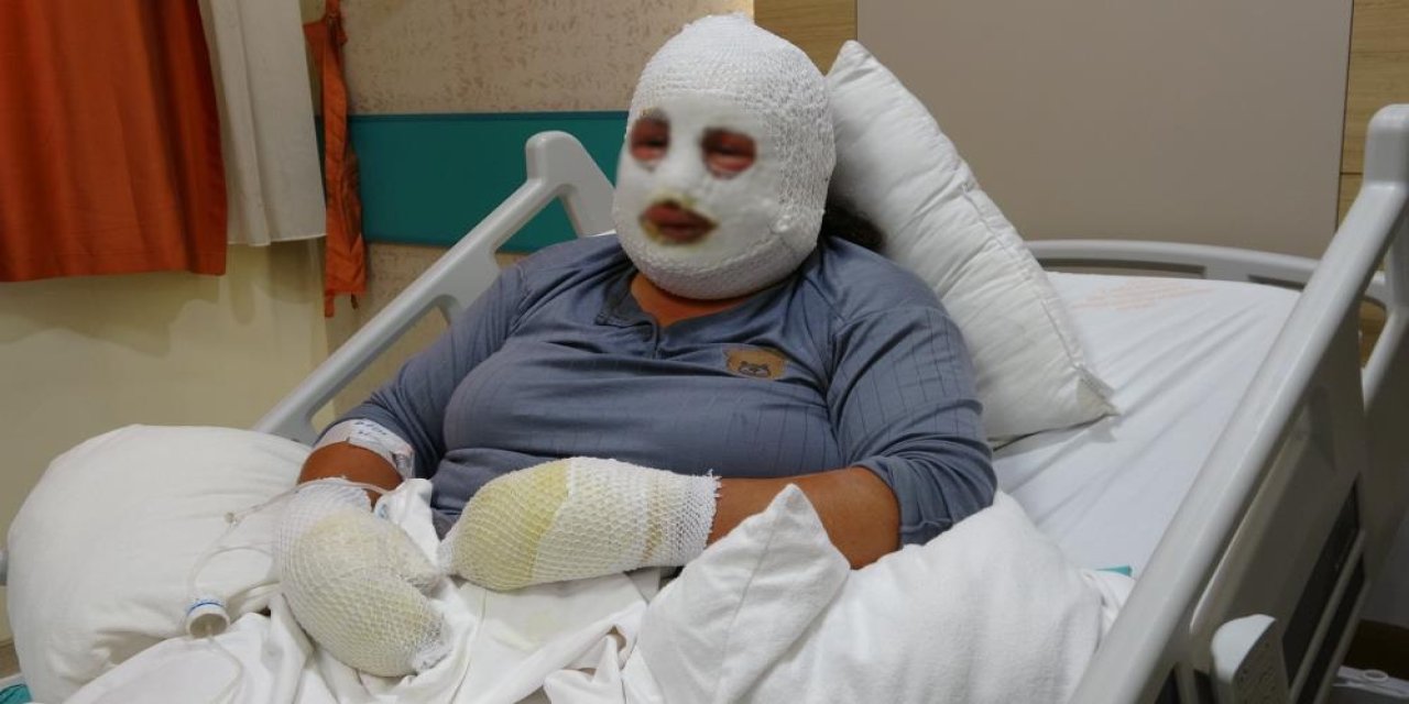 Kızının “Anne” çığlığını duydu, alevlerin arasına daldı! Anne de kızı da yaralandı