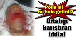 Polis dayağı mı?