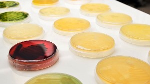 ETÜ laboratuvarlarında yeni nesil antibiyotikler üretilecek