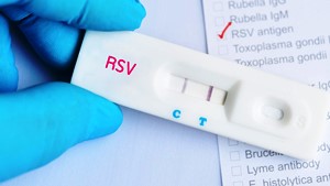 RSV Virüsü küçük yaşta çocukları tehdit ediyor