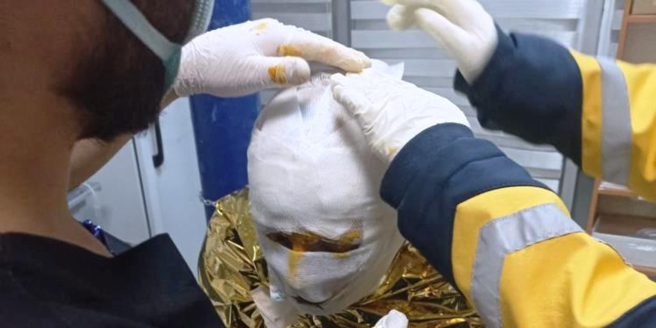 Erzurum'da kömür ocağında yangın: 2 işçi yaralı