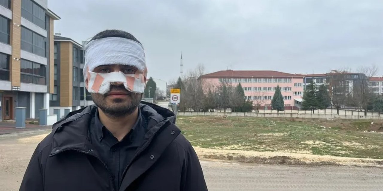 Lisede dehşet anları! Öğretmenin yüzüne kaynar çay fırlattı