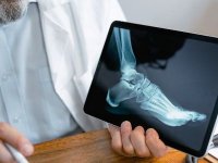 Osteokondrom ve Pudendal Sinir Sıkışması Ameliyatları