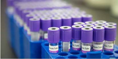 Yanlış kandan ölüme 240 bin lira tazminat